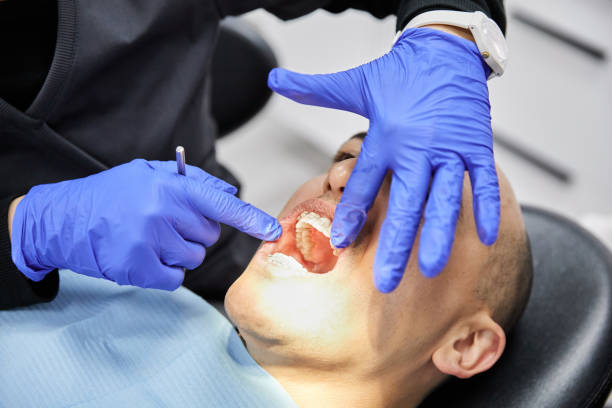 Best Emergency Dental Care for Broken or Chipped Teeth in Beloit, KS