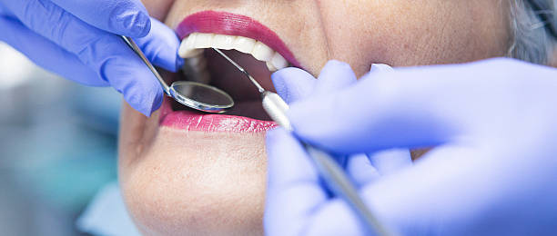 Best Emergency Treatment for Dental Infections or Abscesses in Beloit, KS